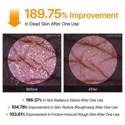 GlowRefine™  Brightening Exfoliating Skin Peel Shot